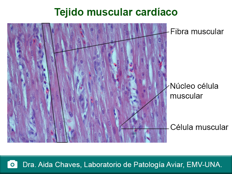 Tejido muscular cardíaco