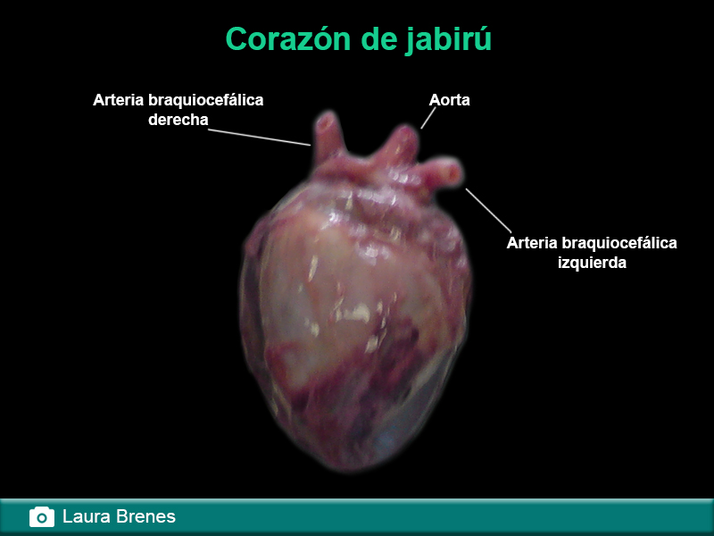 Corte longitudinal del corazón de un jabirú