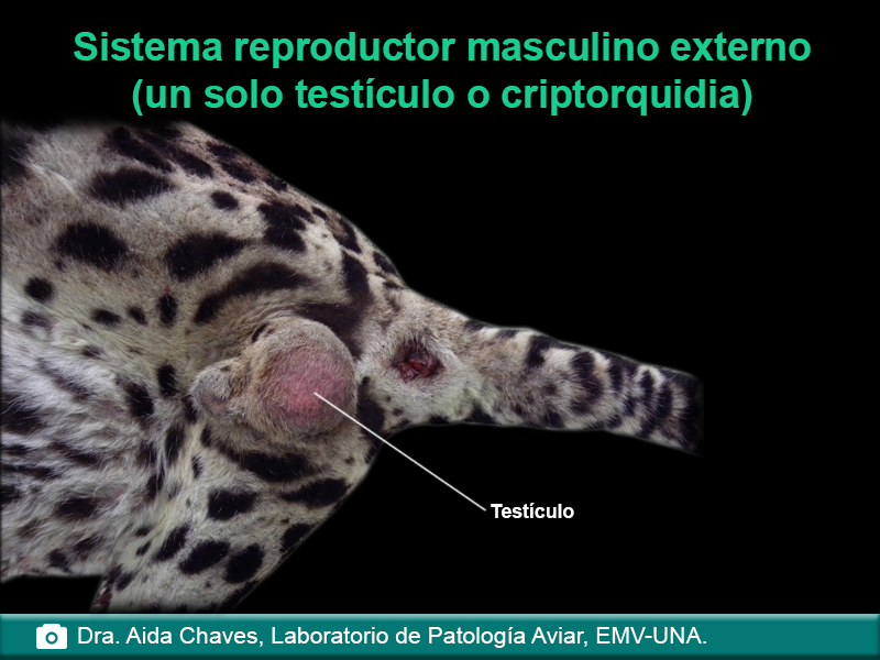 Sistema reproductor masculino externo (un solo testículo o criptorquidia)