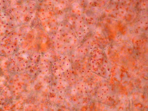 Micrografía de células de chile rojo en las que se observan agrupaciones de cromoplastos.