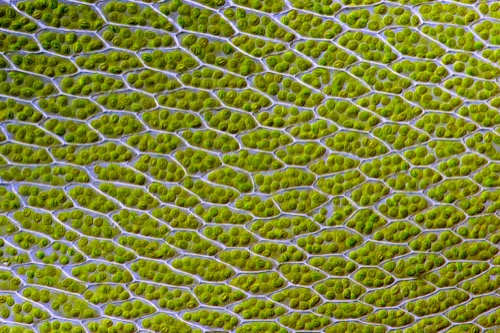Células vegetales en las que se observan alrededor de diez cloroplastos en cada una.