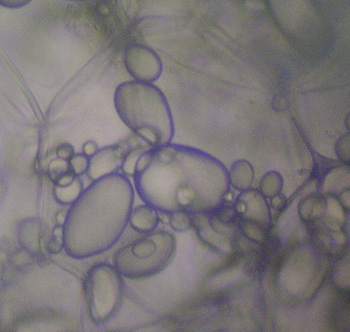 Células de papa en las que se observan plastidios incoloros.